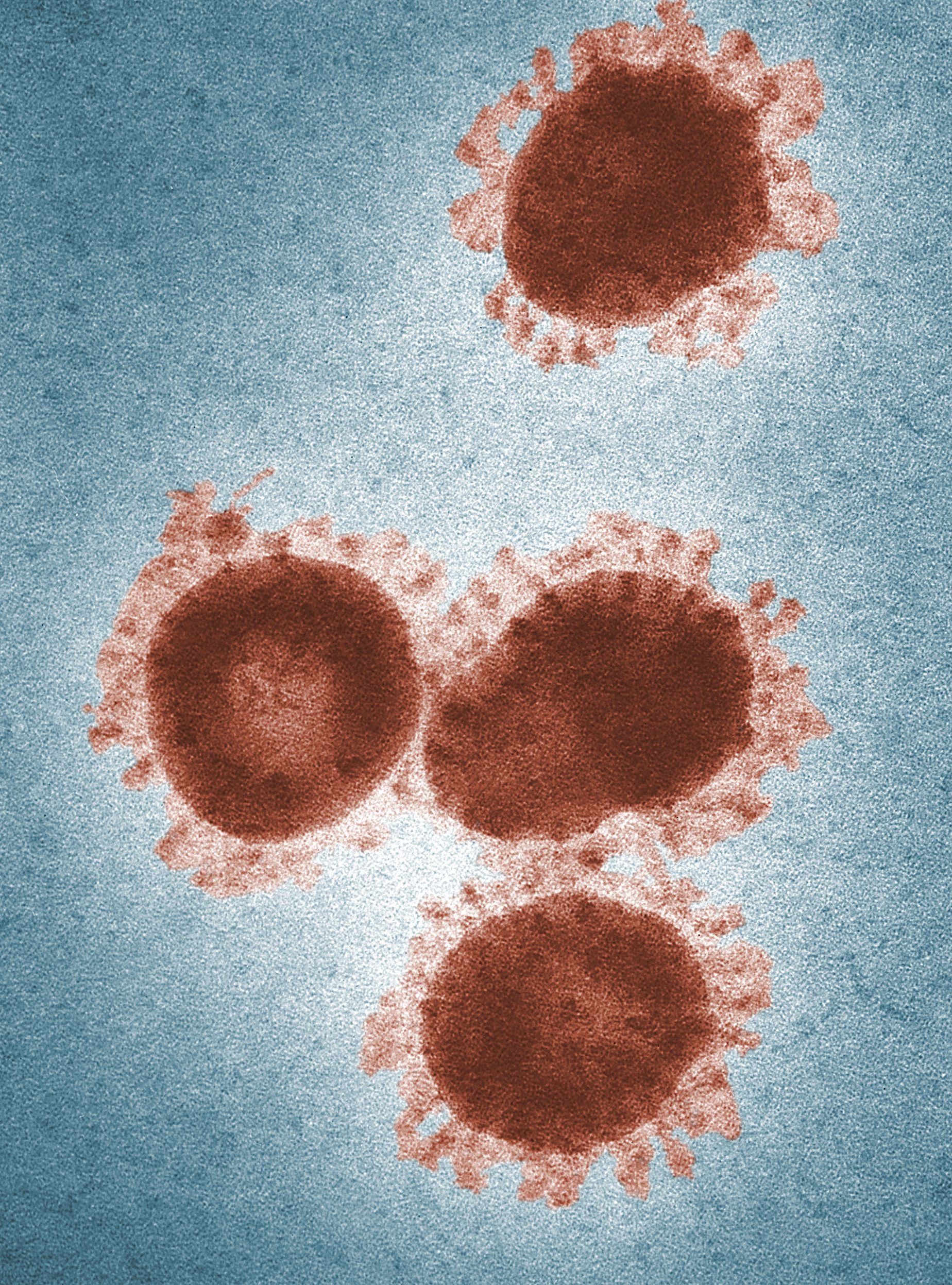 Understanding the Zika Virus: Symptoms, Prevention, and Treatment
