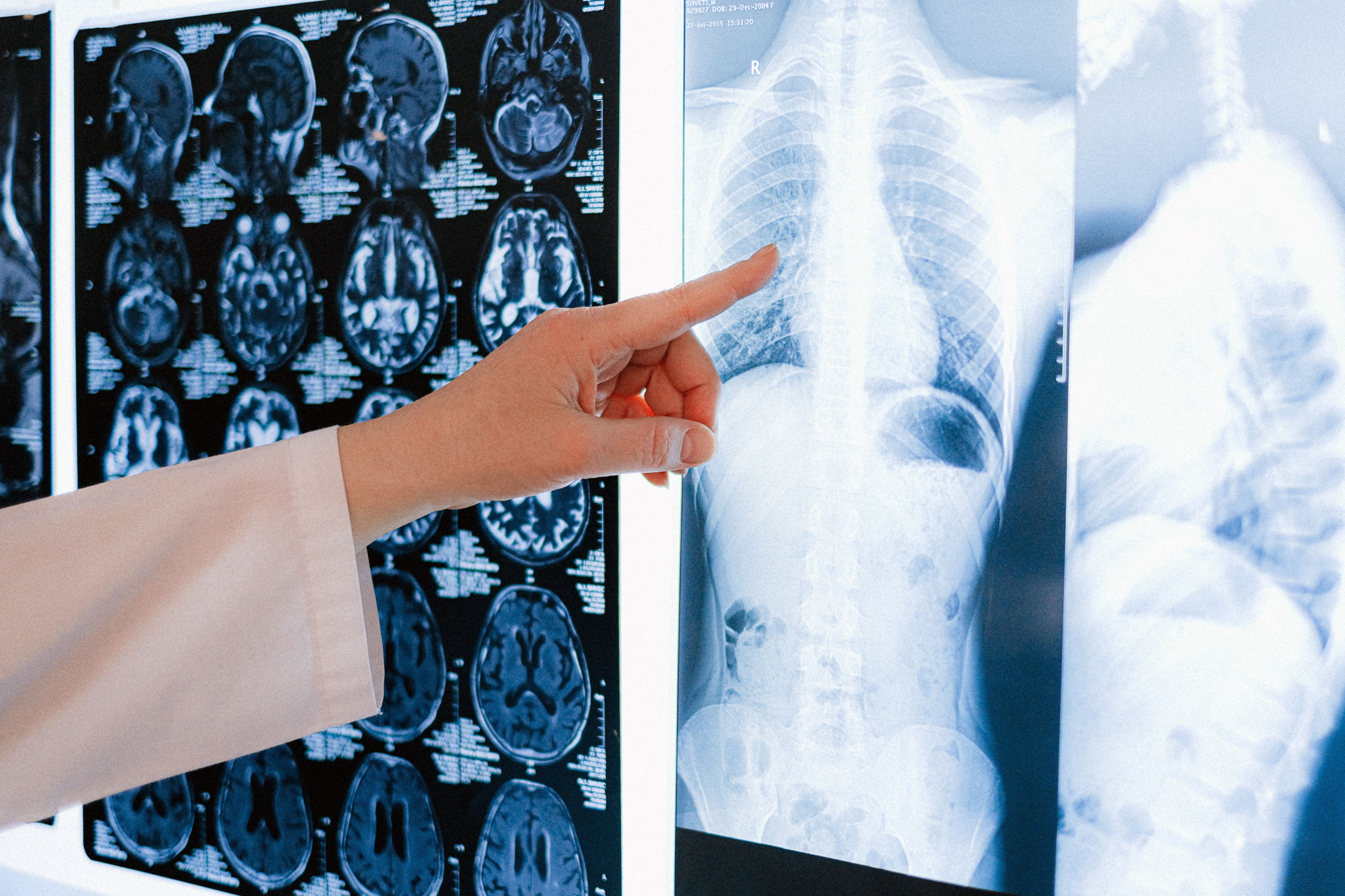 Bone Health Essentials: Foods That Support Strong Bones