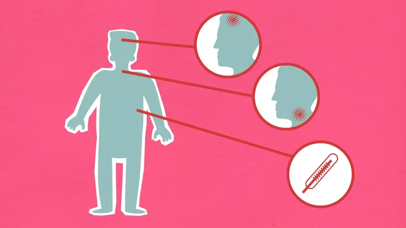 Cherry Angioedema: Understanding Symptoms, Causes, and Treatment Options